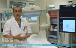 http://Maladie%20de%20Rendu-Osler